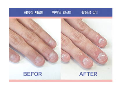 Geukan Top Gel [SHOWME Korea]